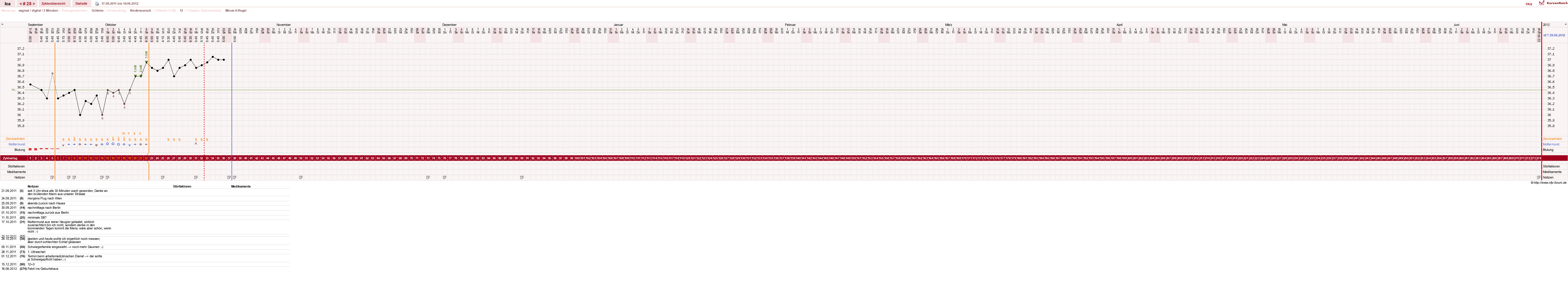 NFP-Kurve User #10163