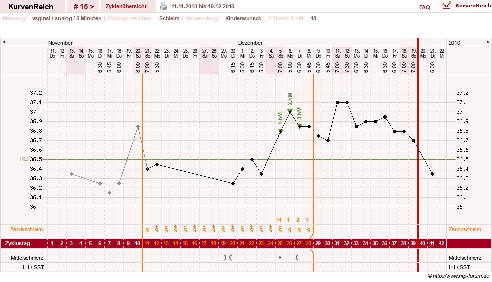 NFP-Kurve User #10274