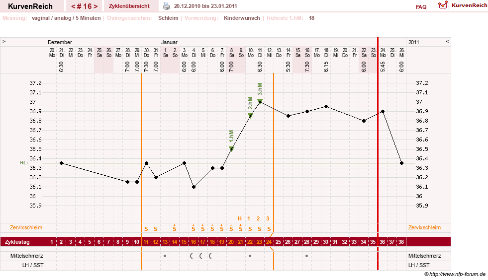 NFP-Kurve User #10274