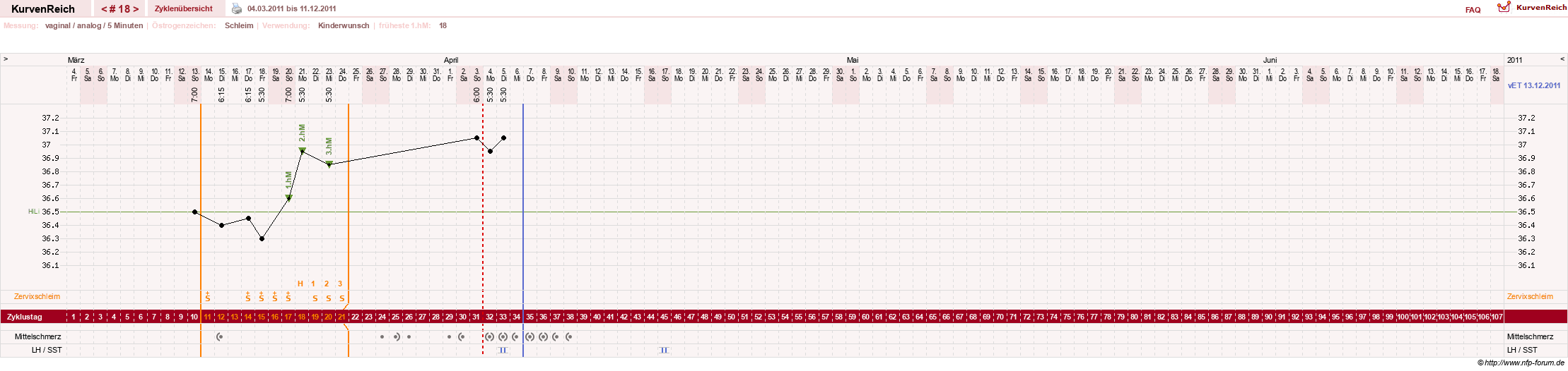 NFP-Kurve User #10274