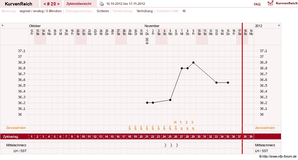 NFP-Kurve User #10274