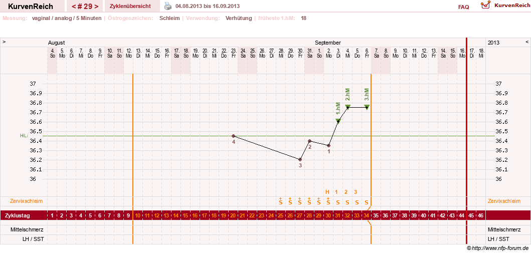 NFP-Kurve User #10274