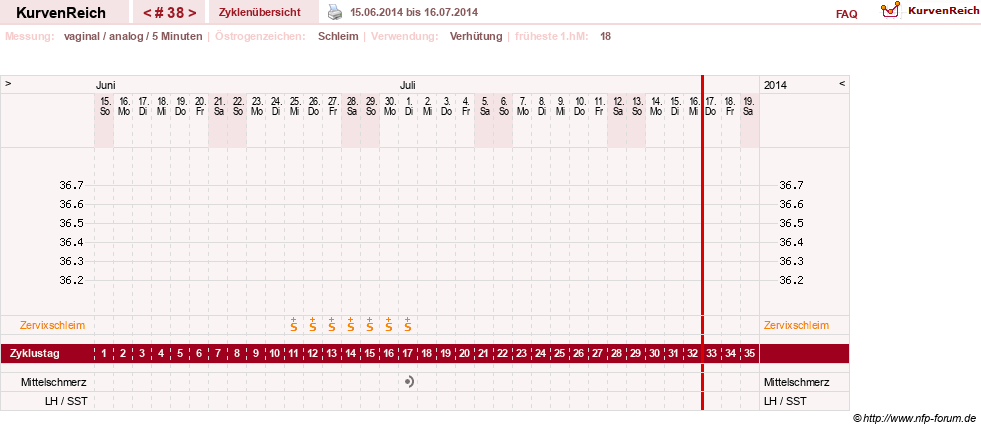 NFP-Kurve User #10274