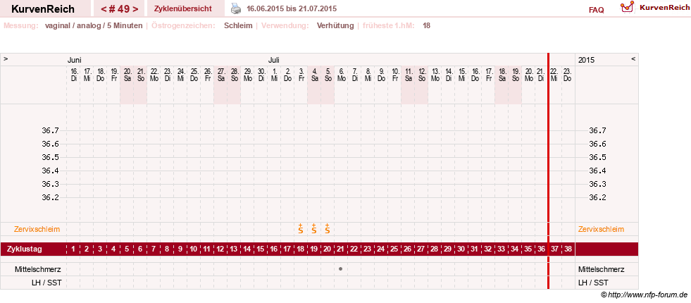 NFP-Kurve User #10274