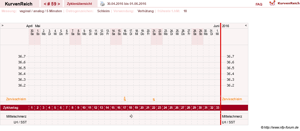 NFP-Kurve User #10274