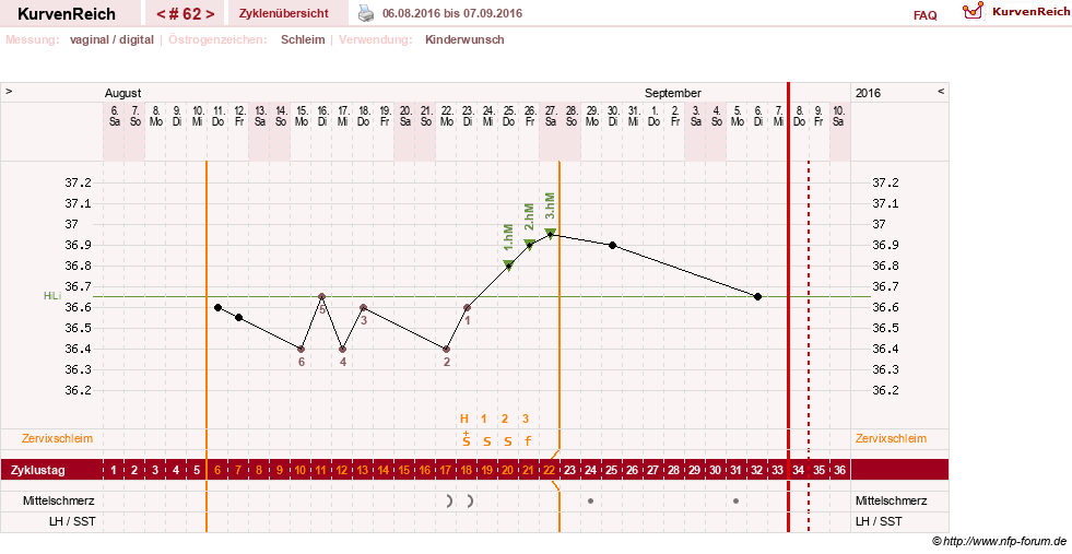 NFP-Kurve User #10274