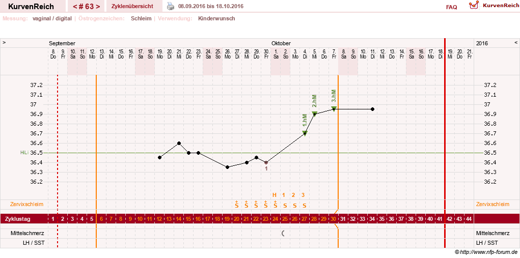 NFP-Kurve User #10274