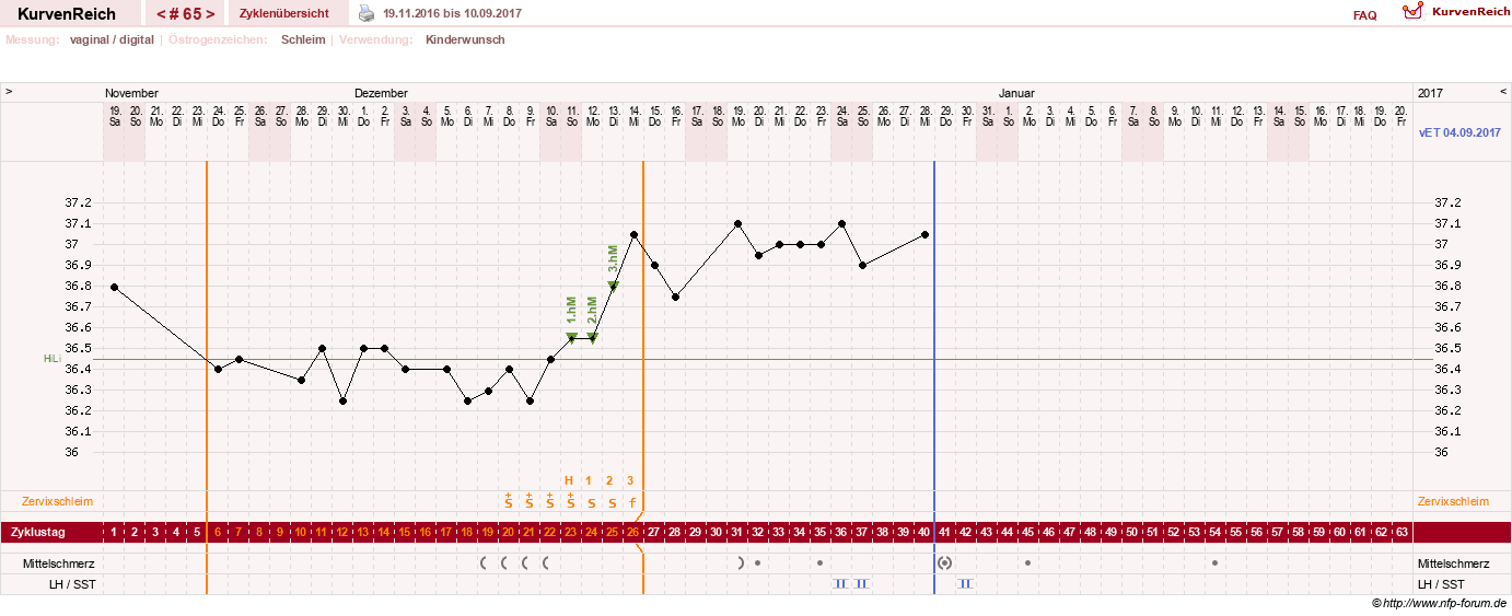NFP-Kurve User #10274