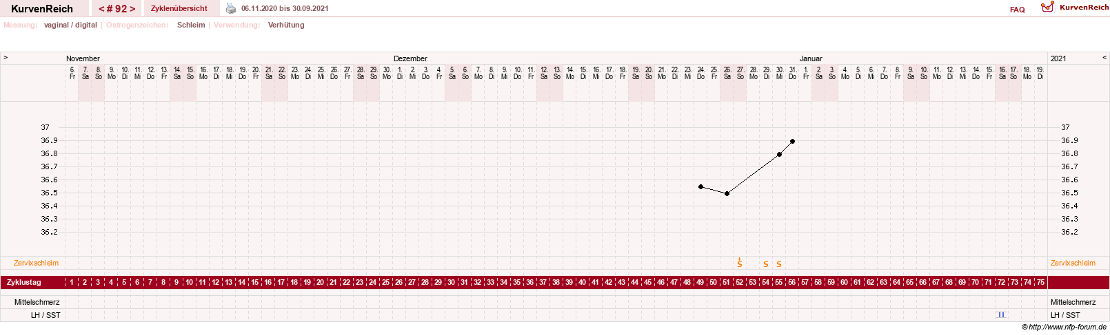 NFP-Kurve User #10274