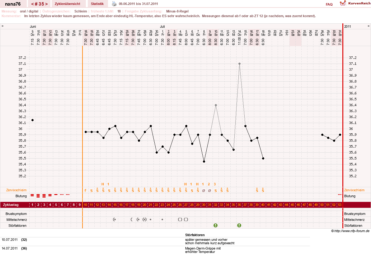 NFP-Kurve User #10464