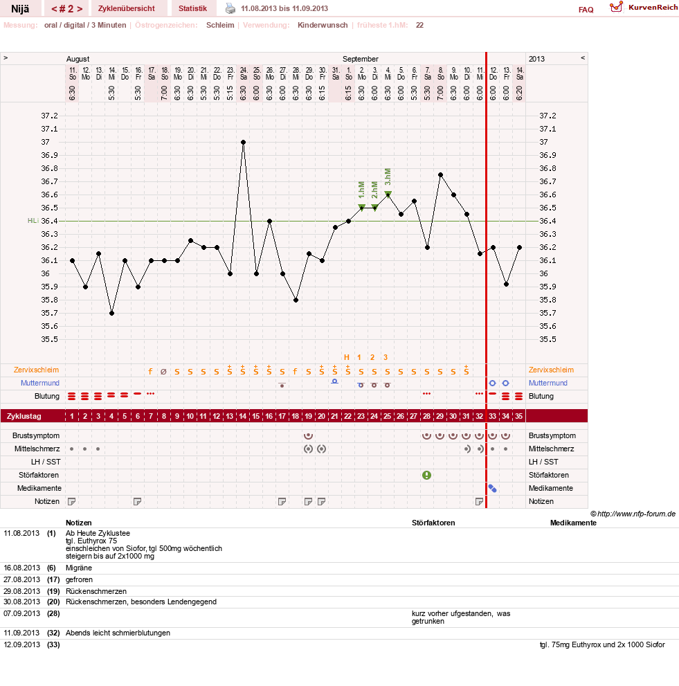 NFP-Kurve User #10481