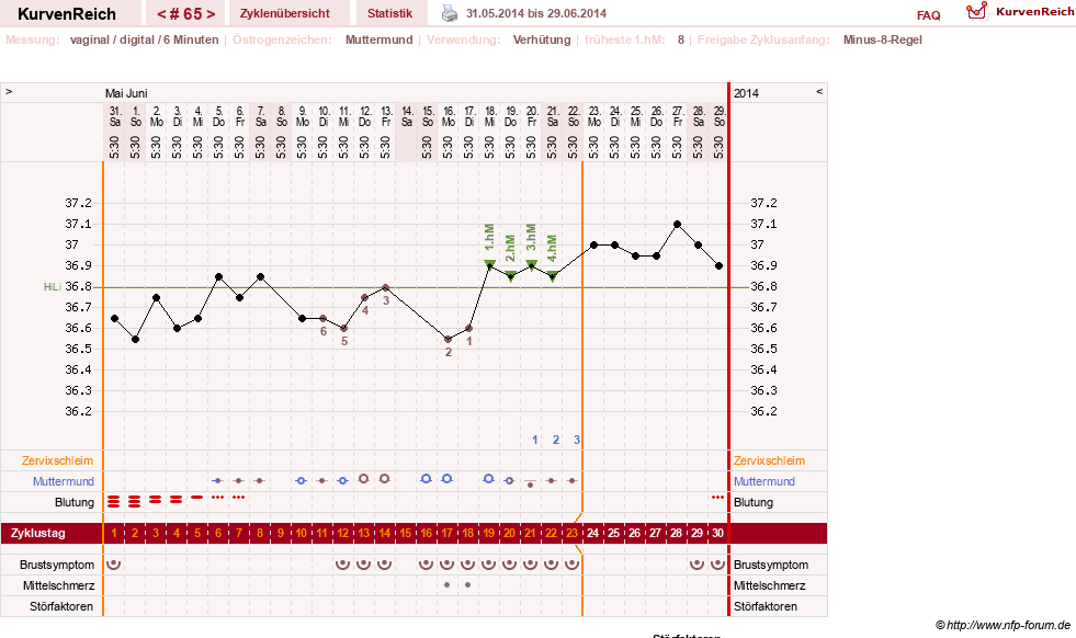 NFP-Kurve User #11007