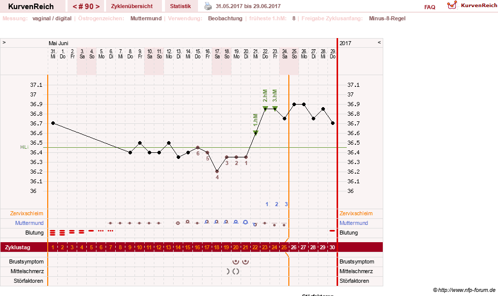 NFP-Kurve User #11007