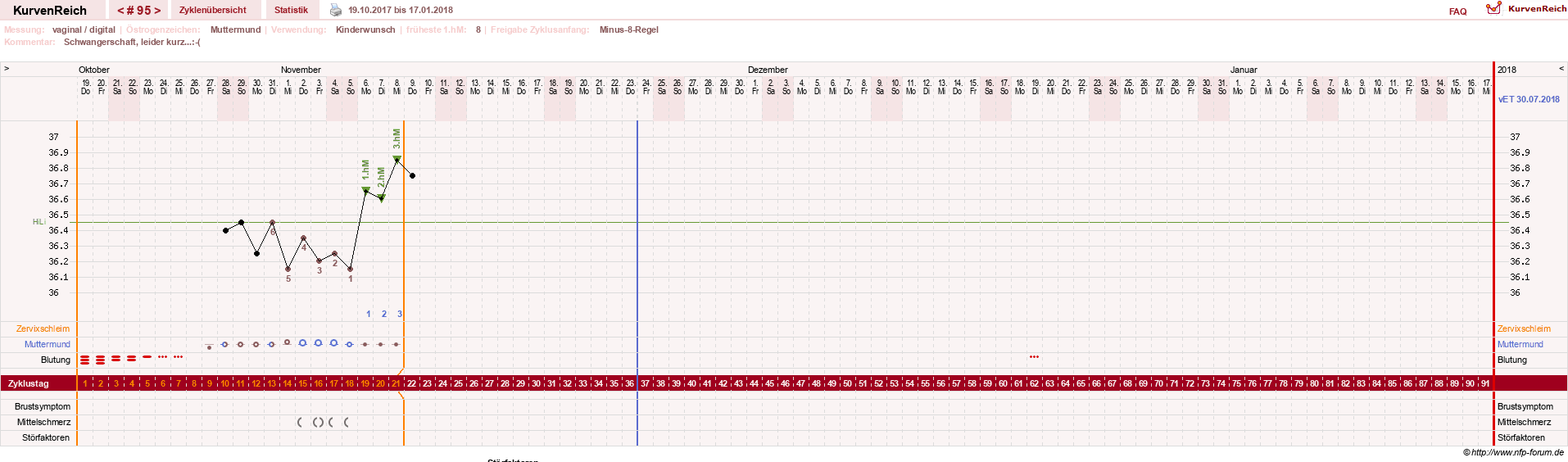 NFP-Kurve User #11007