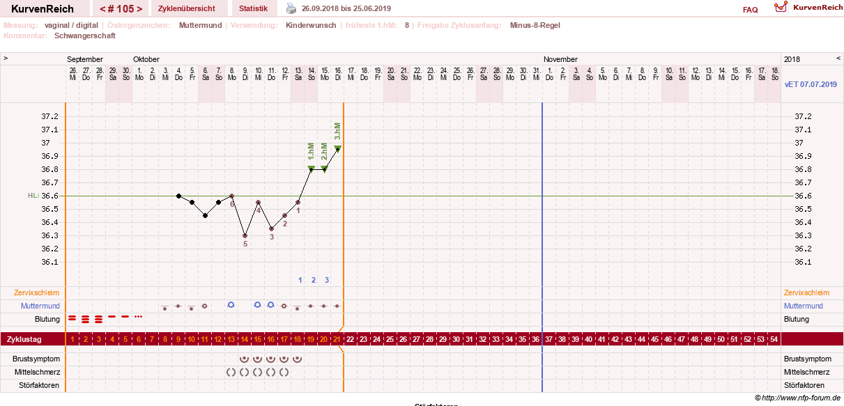 NFP-Kurve User #11007