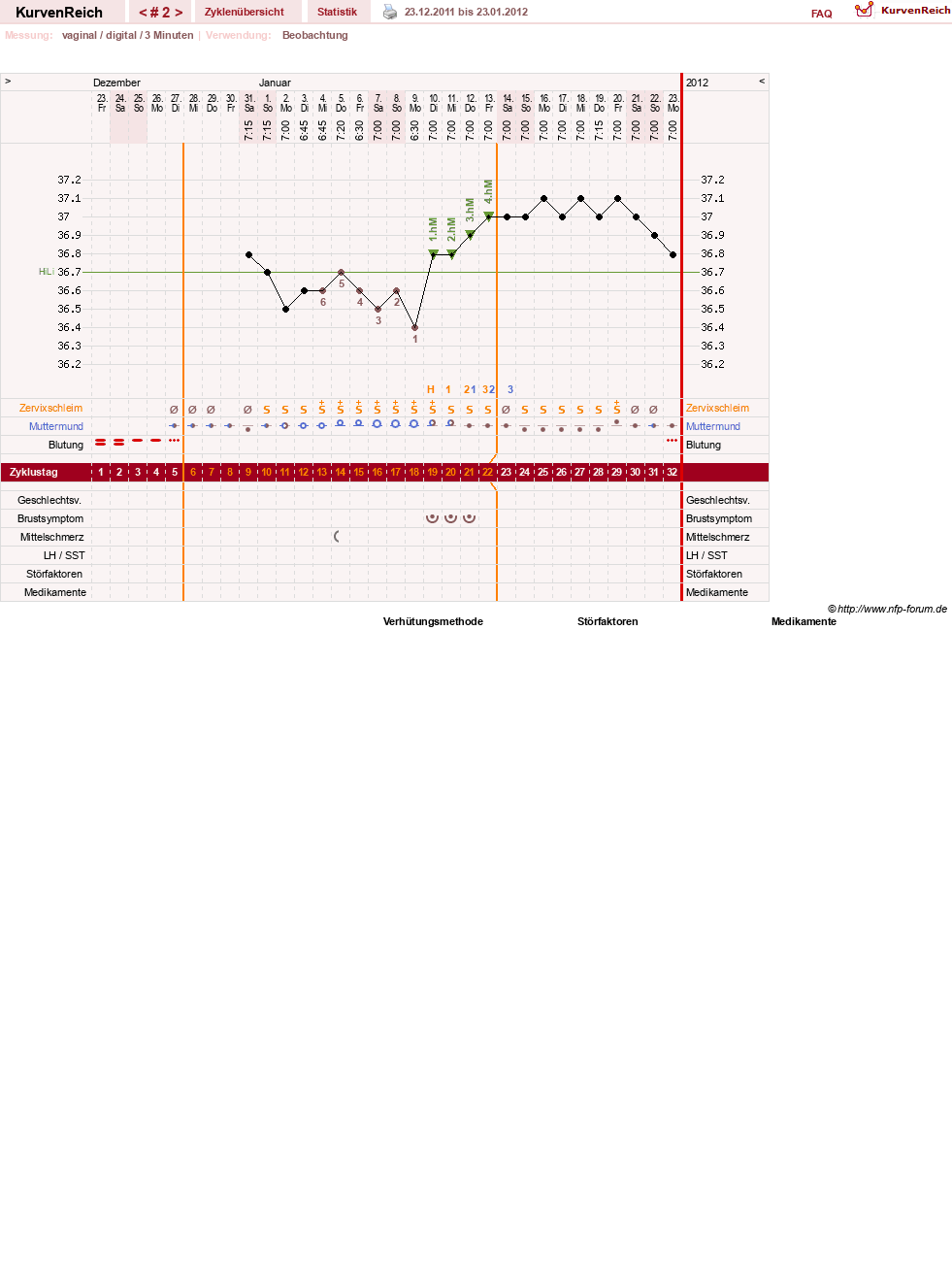 NFP-Kurve User #11173