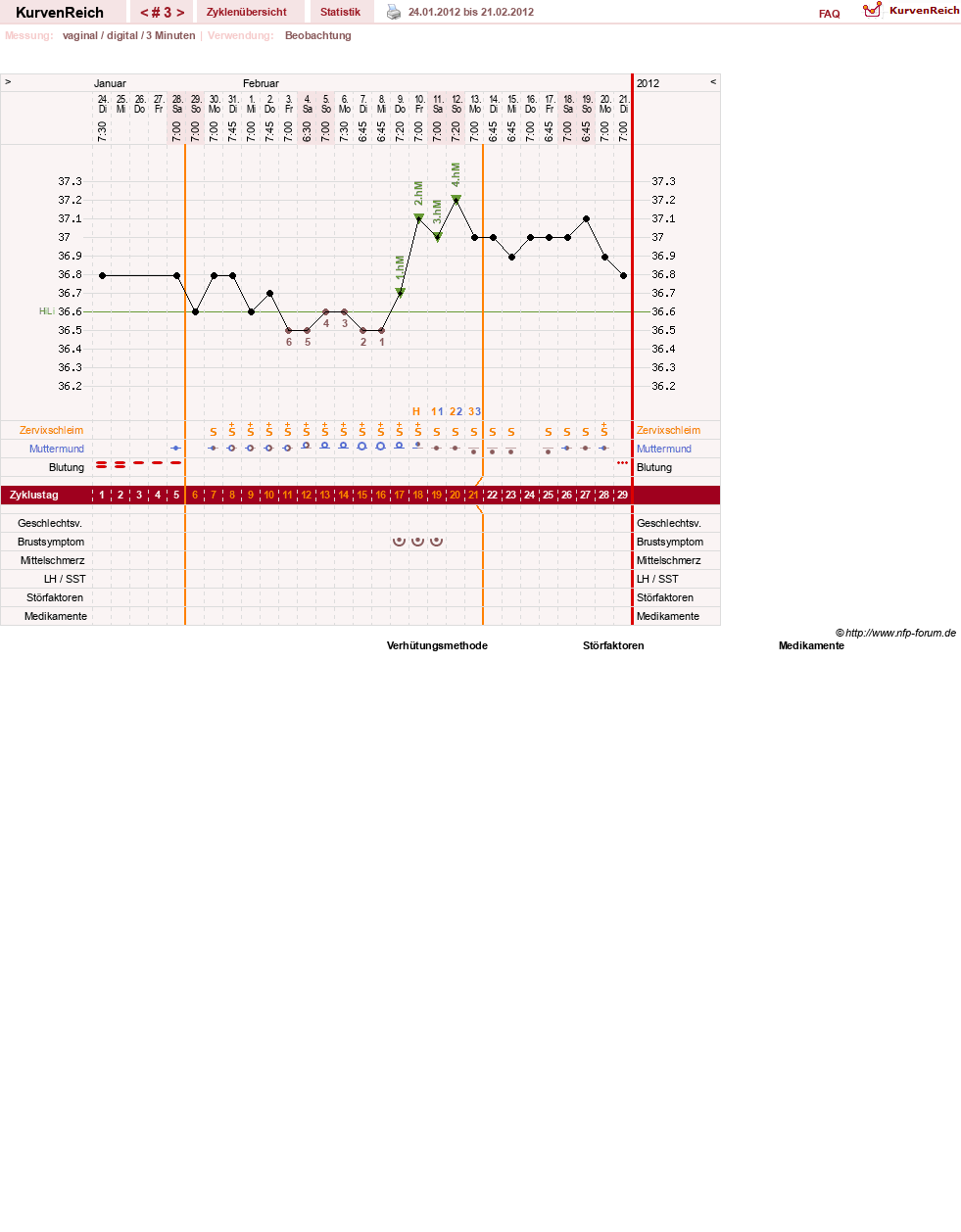 NFP-Kurve User #11173