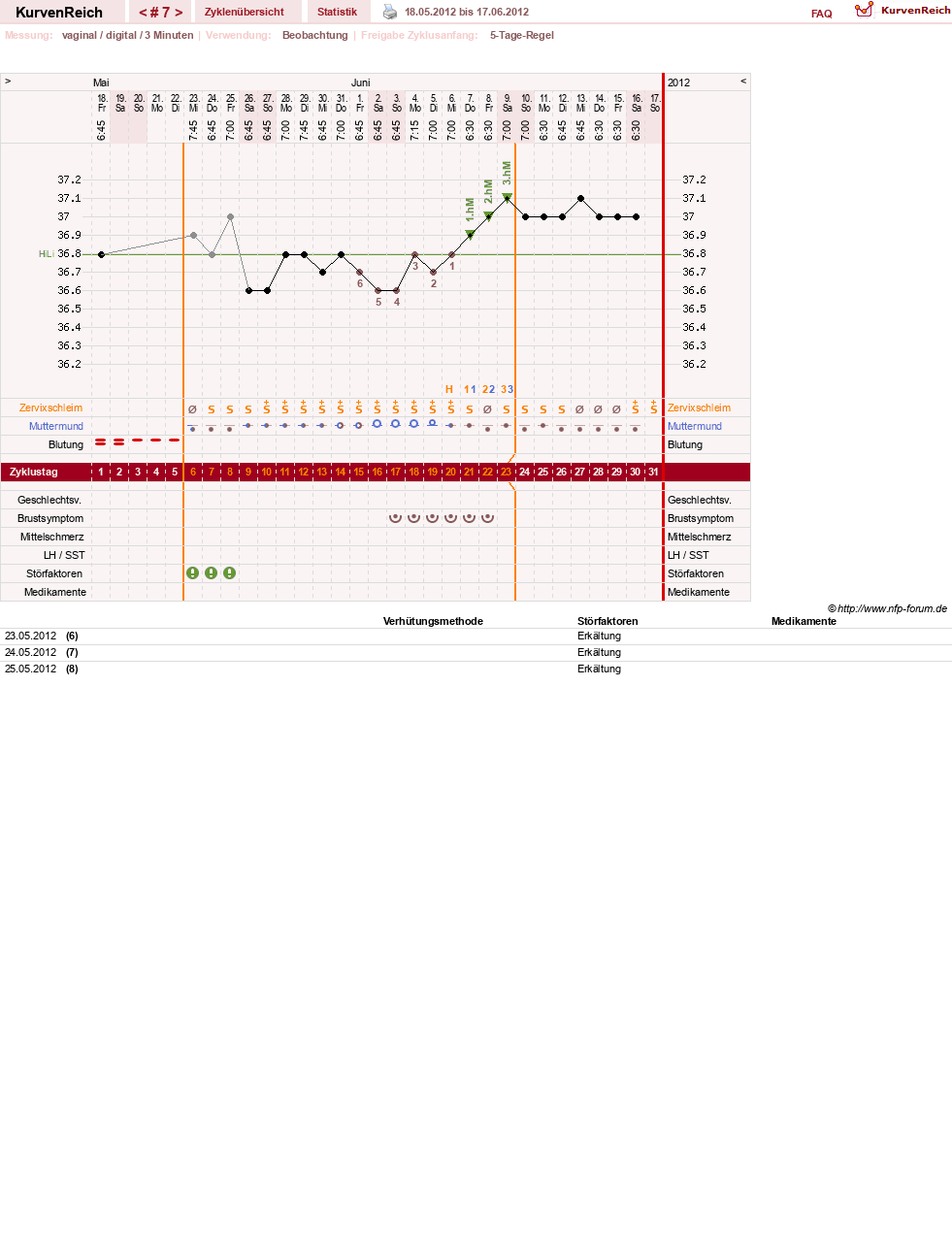 NFP-Kurve User #11173