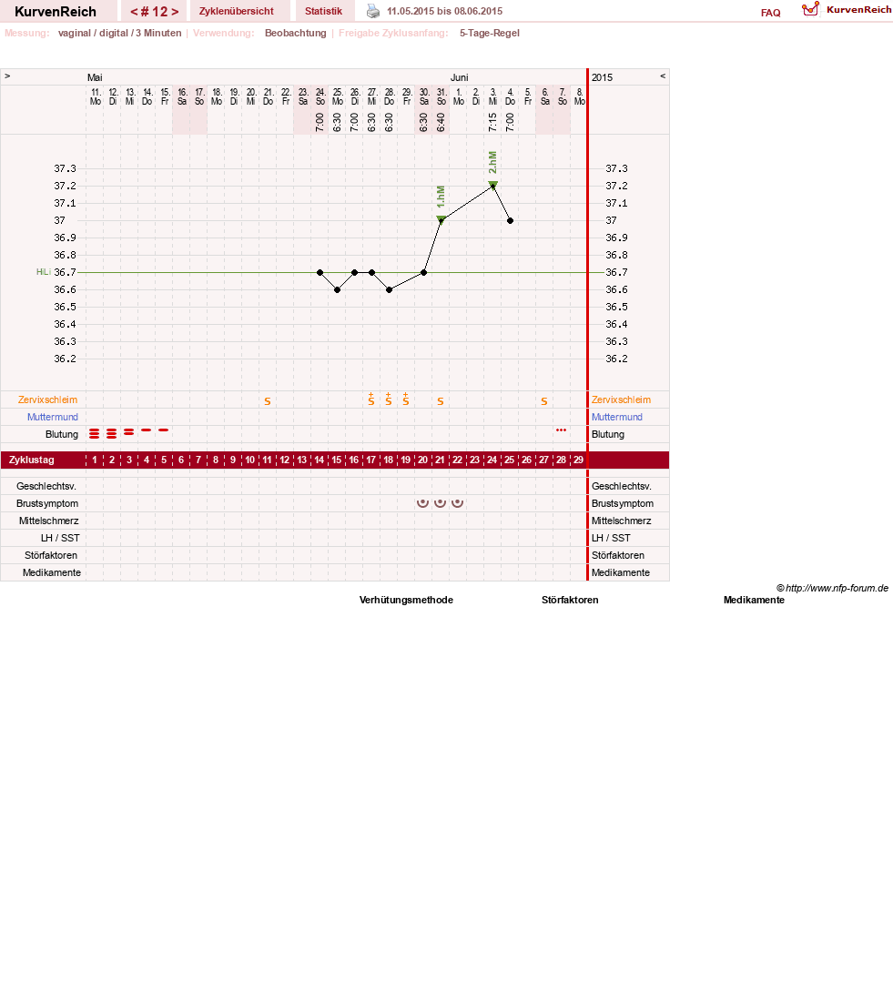 NFP-Kurve User #11173