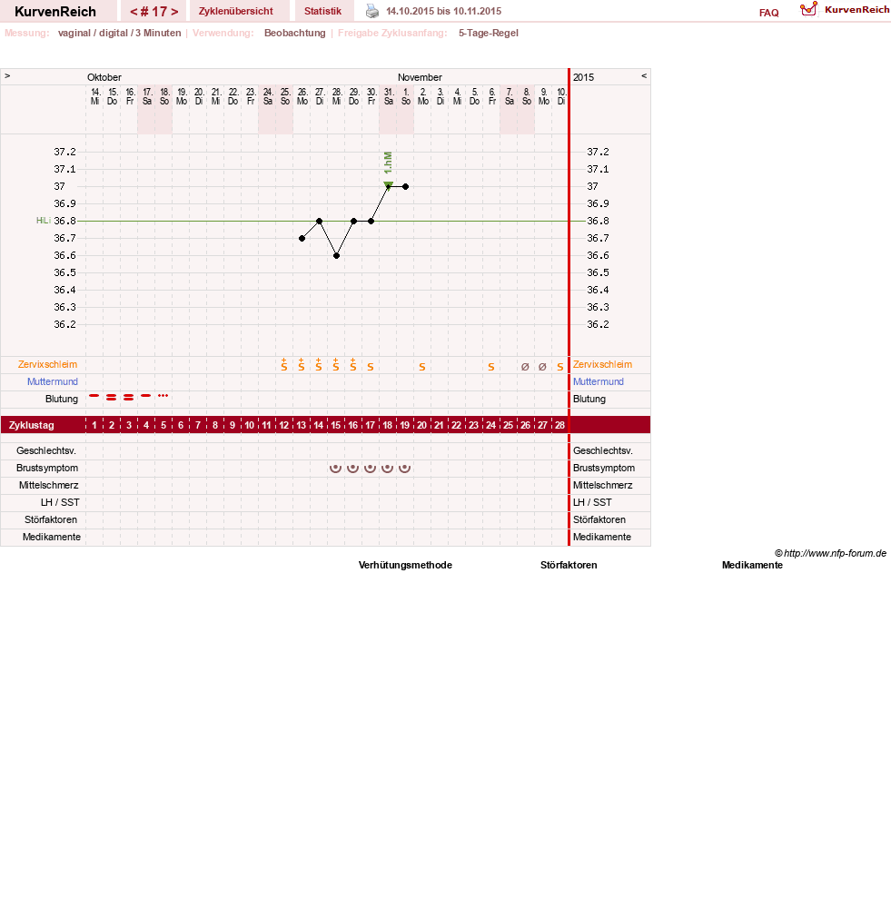 NFP-Kurve User #11173
