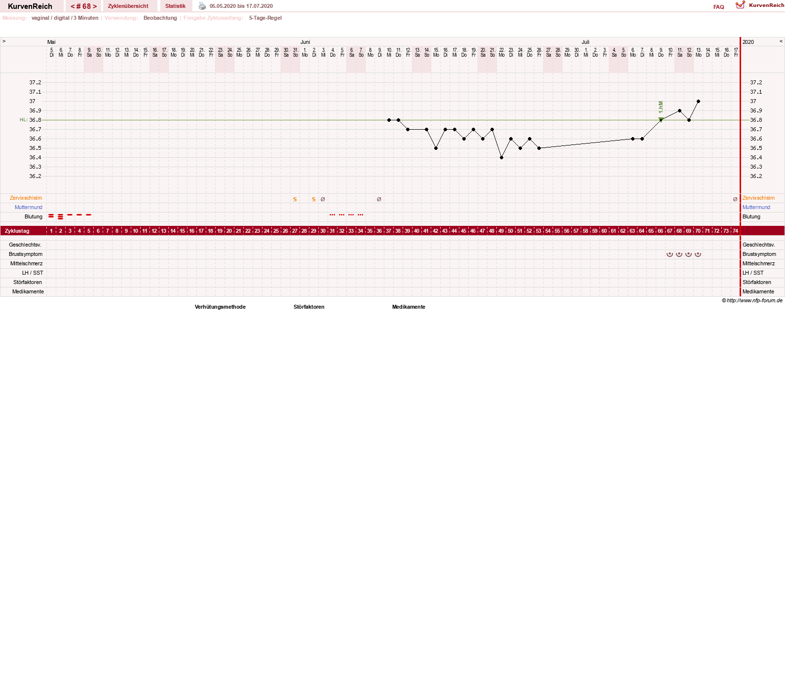 NFP-Kurve User #11173