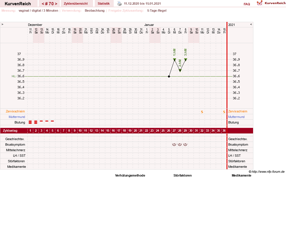 NFP-Kurve User #11173