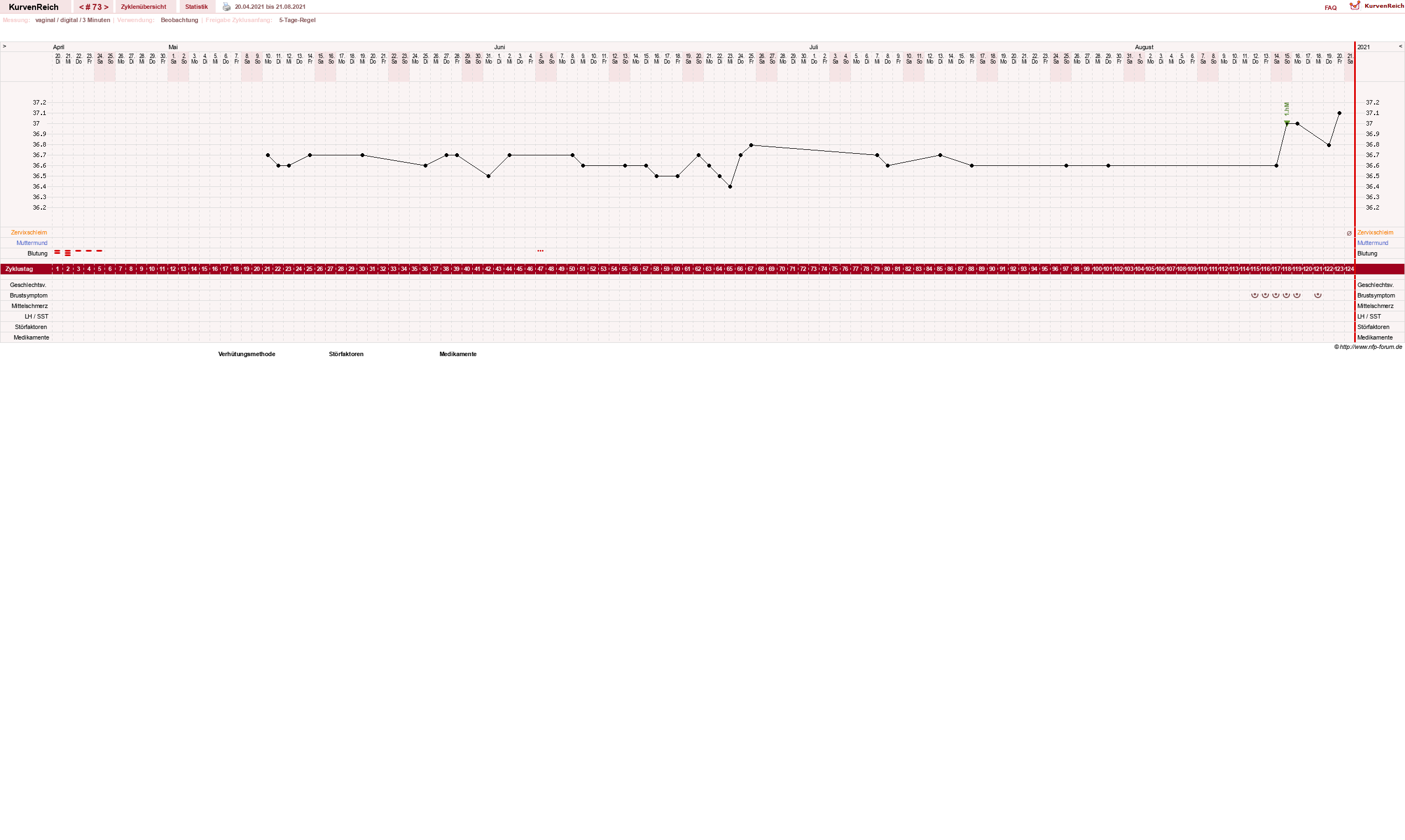 NFP-Kurve User #11173