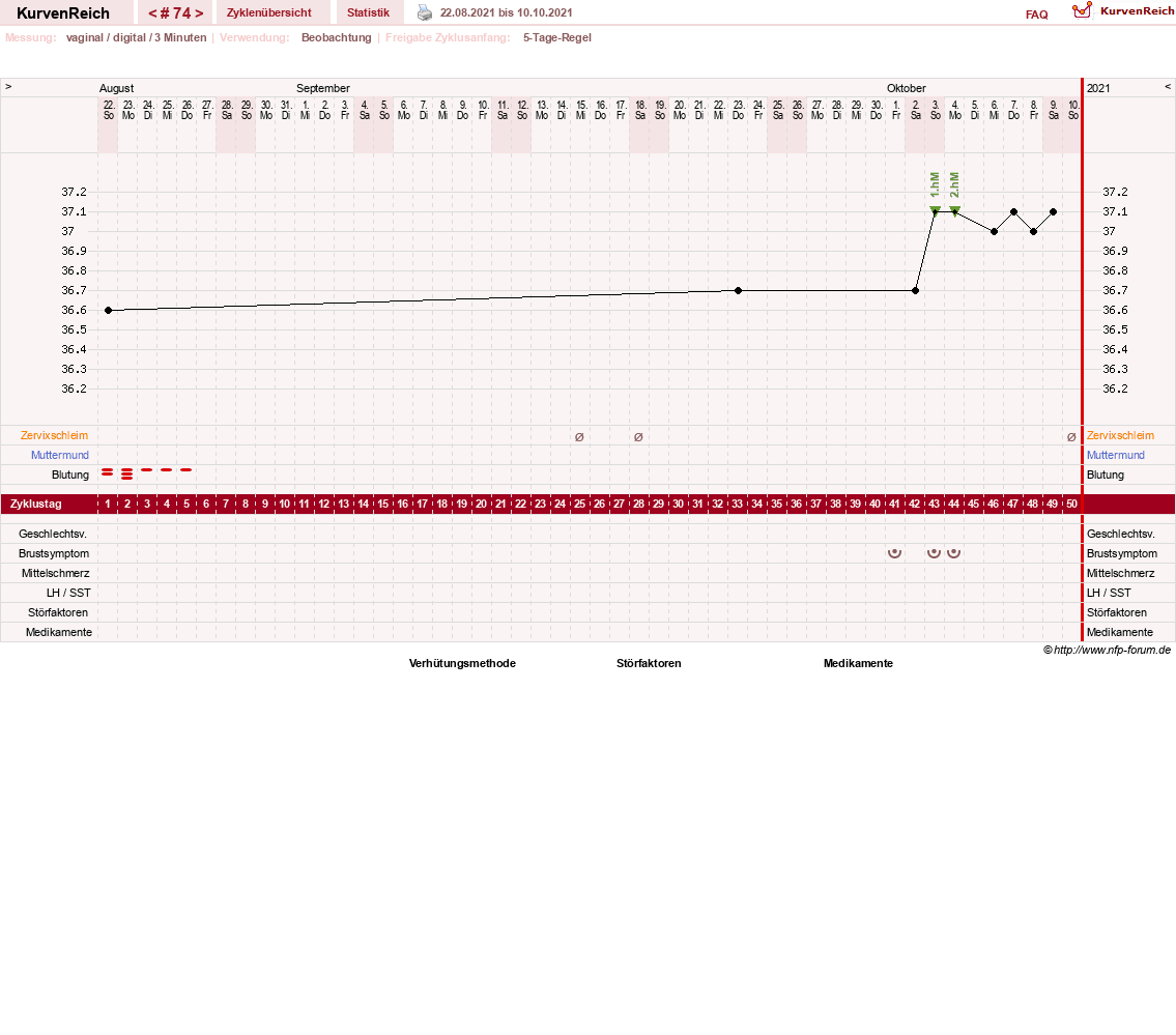 NFP-Kurve User #11173