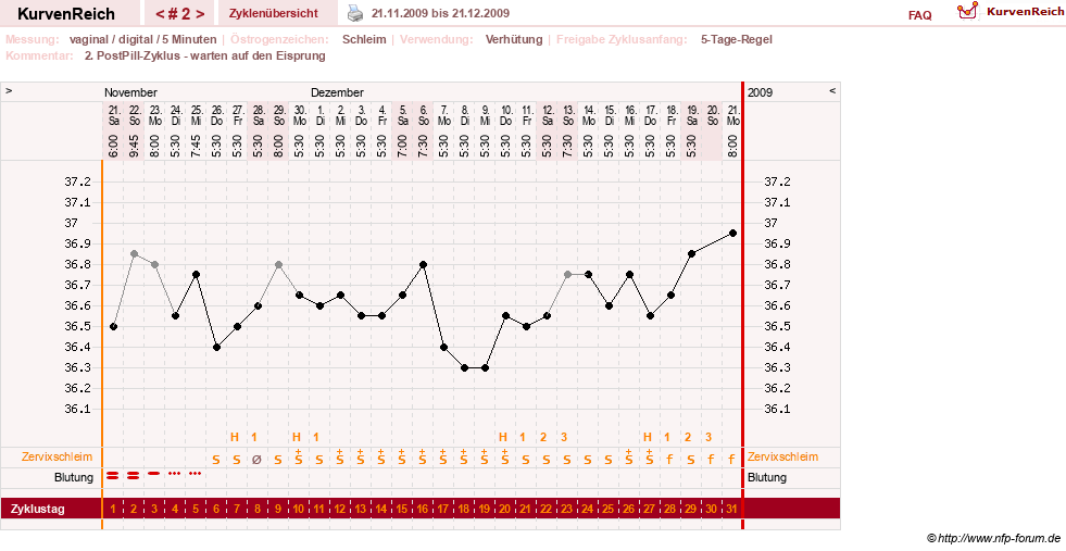 NFP-Kurve User #11351
