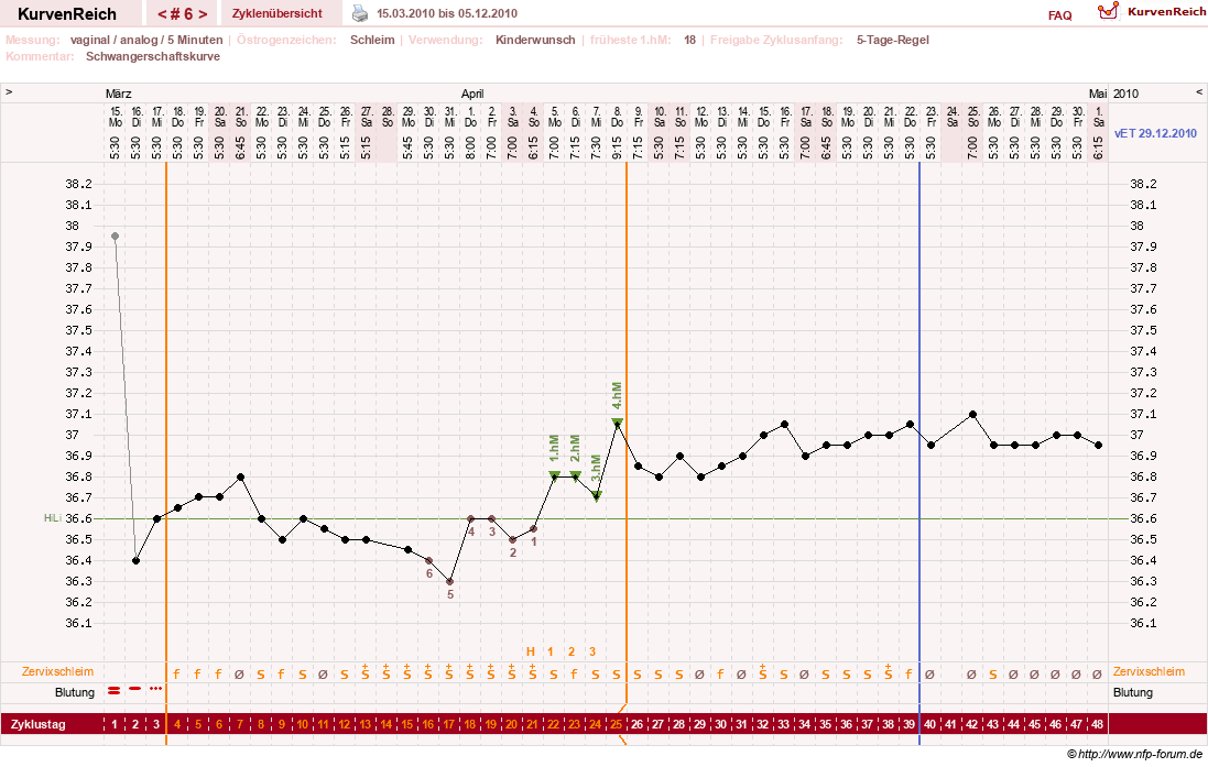NFP-Kurve User #11351