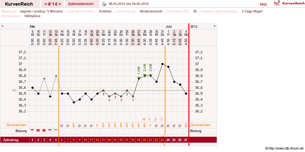 NFP-Kurve User #11351
