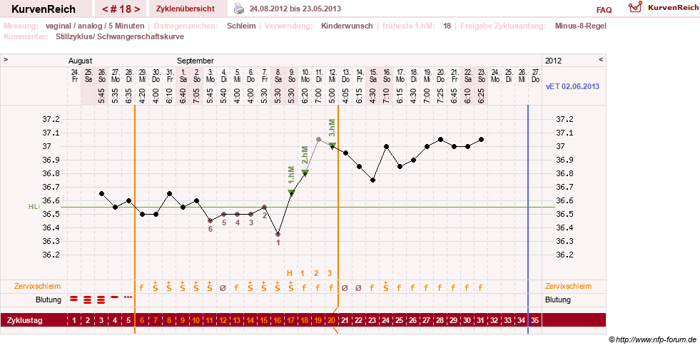 NFP-Kurve User #11351