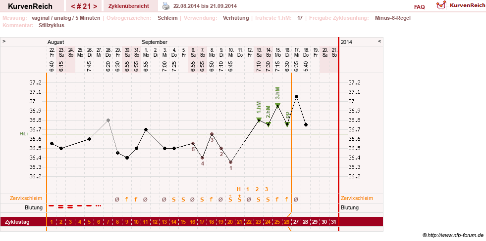 NFP-Kurve User #11351