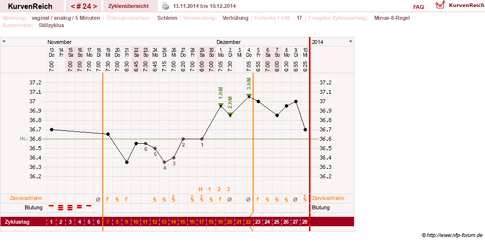 NFP-Kurve User #11351