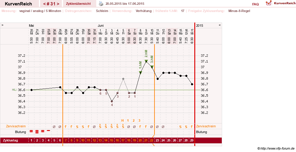 NFP-Kurve User #11351