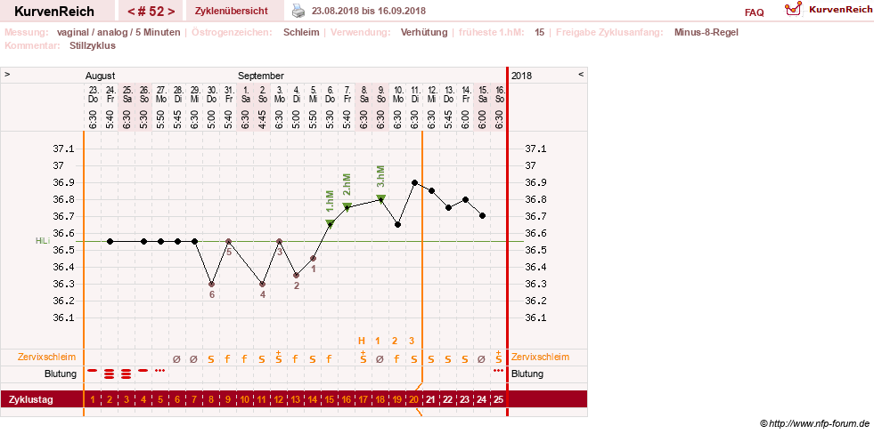 NFP-Kurve User #11351