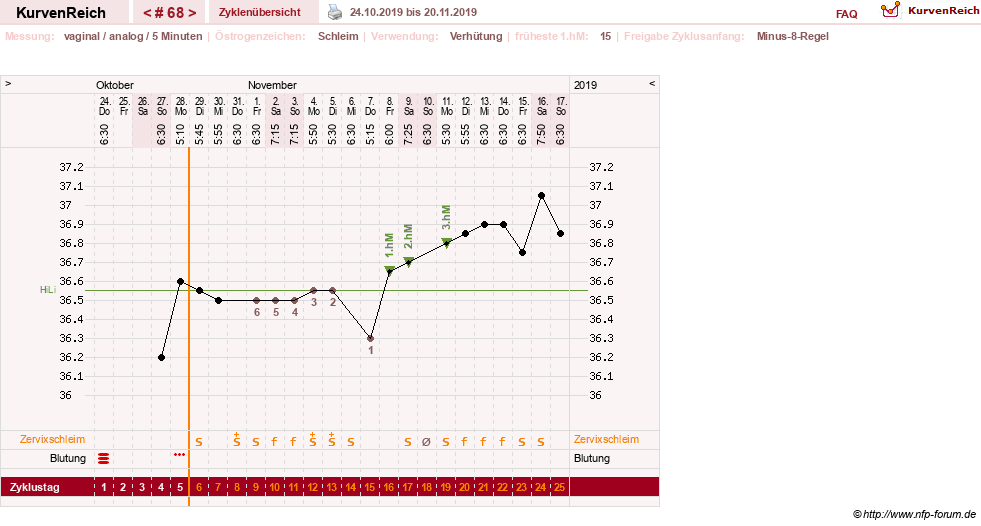 NFP-Kurve User #11351