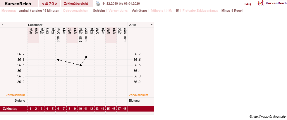 NFP-Kurve User #11351