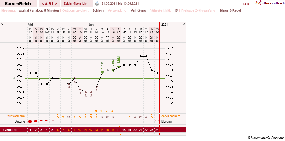 NFP-Kurve User #11351