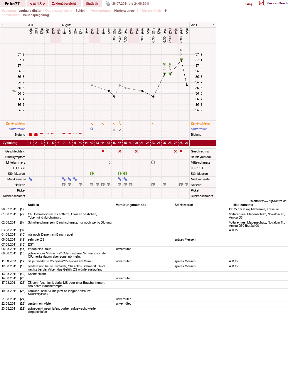 NFP-Kurve User #11386