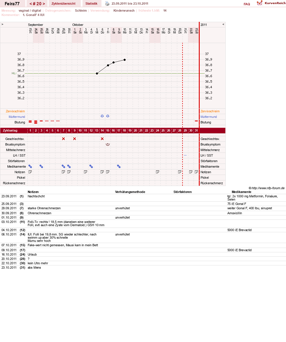 NFP-Kurve User #11386