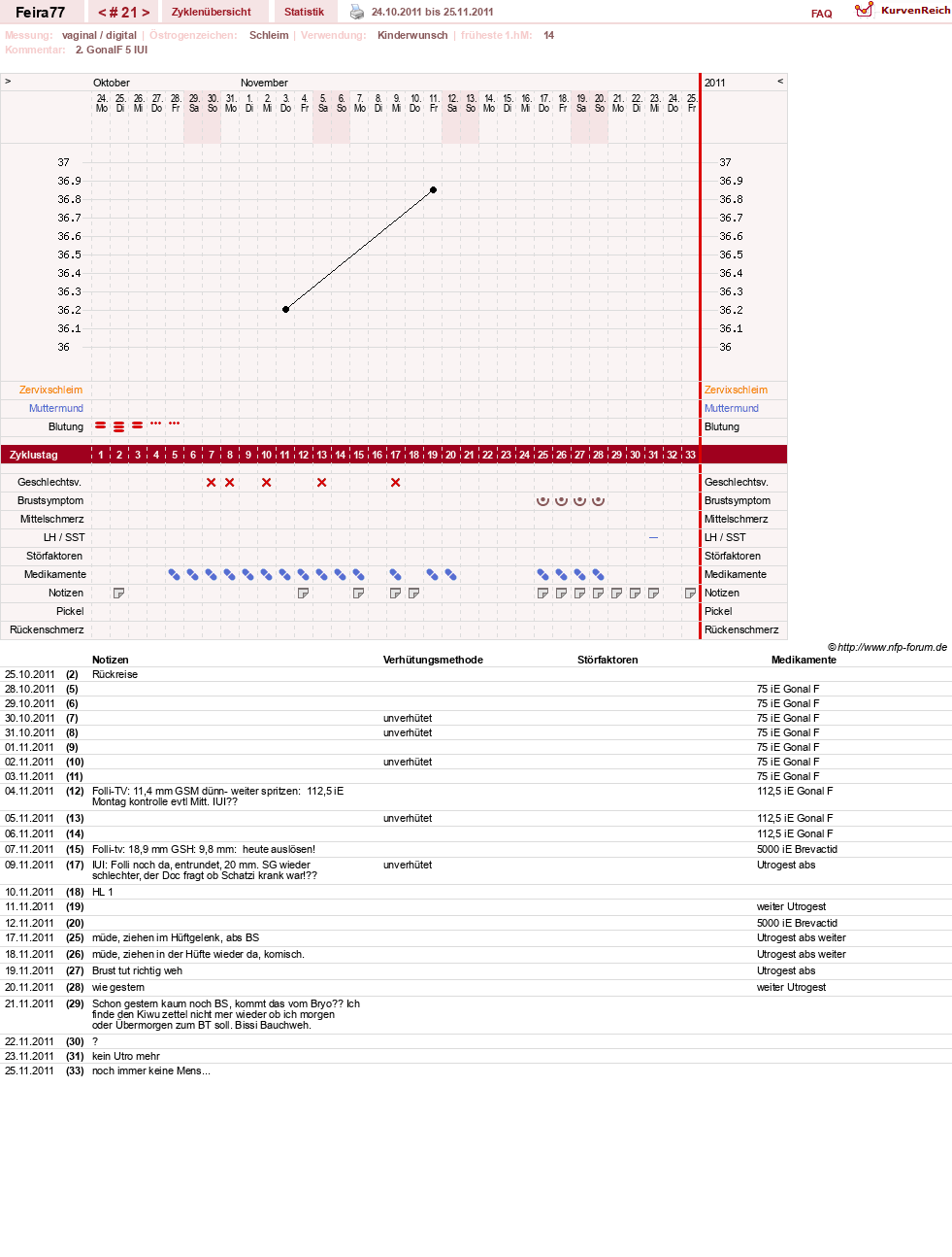 NFP-Kurve User #11386