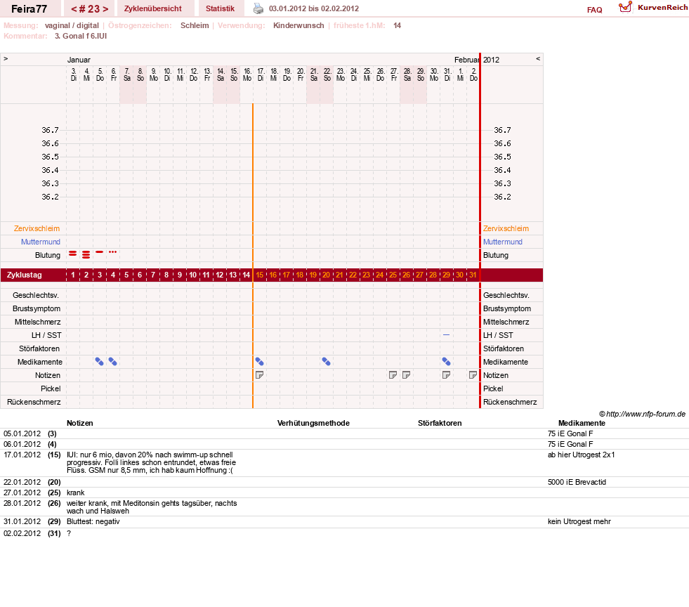 NFP-Kurve User #11386