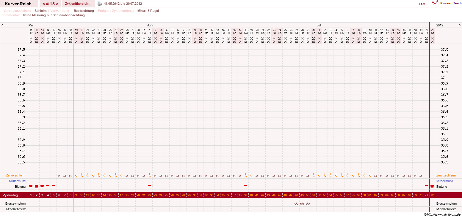 NFP-Kurve User #1147
