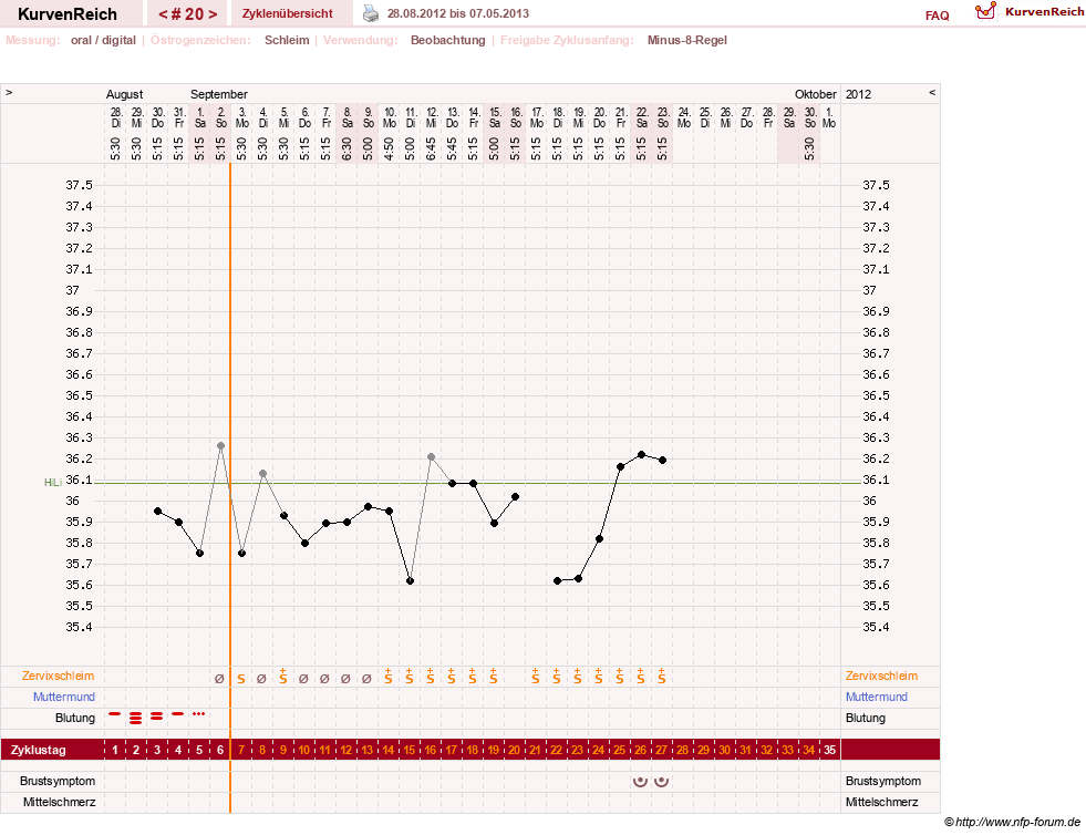 NFP-Kurve User #1147