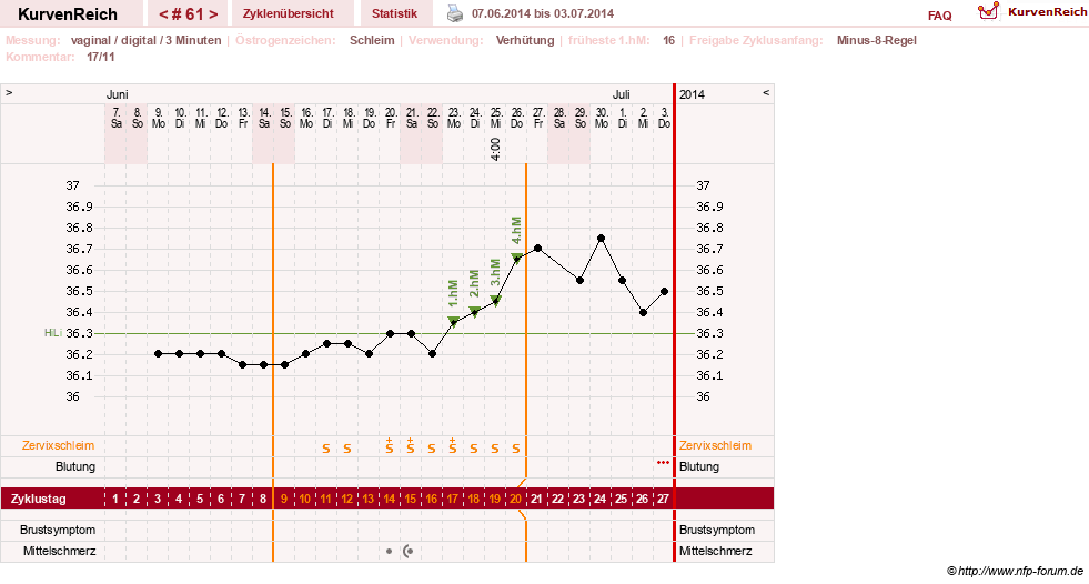 NFP-Kurve User #11903