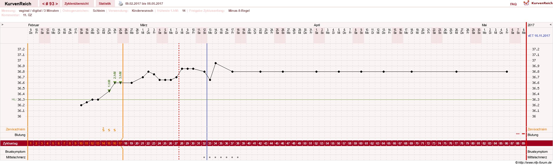 NFP-Kurve User #11903