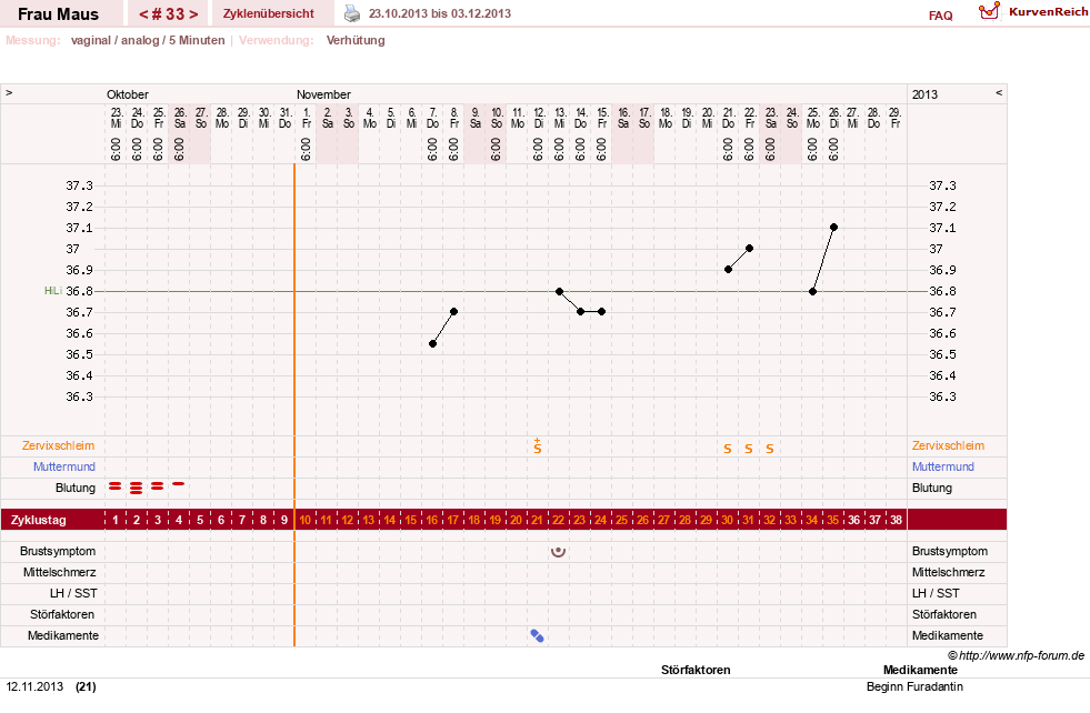 NFP-Kurve User #12121