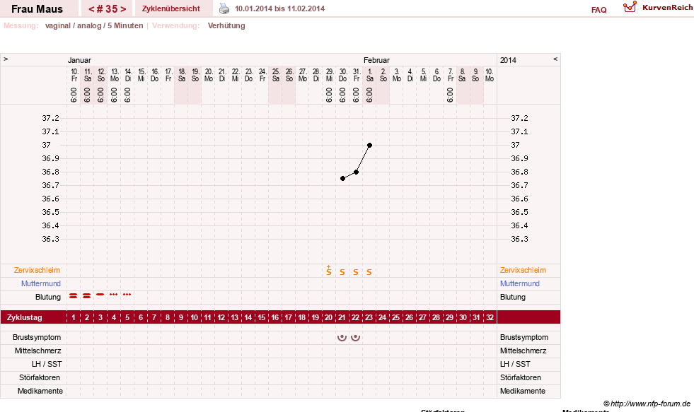 NFP-Kurve User #12121
