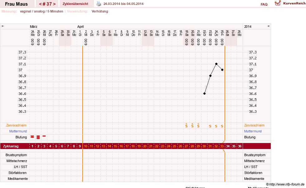 NFP-Kurve User #12121